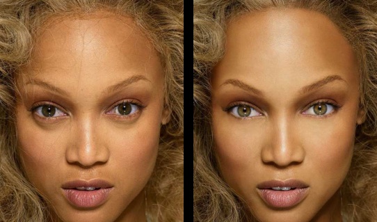 Tyra-banks-face-before-and-after