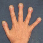fingers1