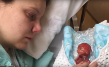 Viņa dzemdēja bērniņu jau piektajā grūtniecības mēnesī. Par spīti visam – viņa vēlējās parādīt pasaulei, cik tas patiesībā ir smagi!