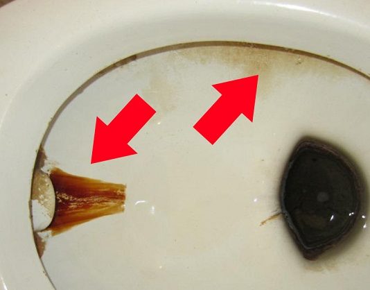 Vienkāršs Triks, Kas Palīdzēs Atbrīvoties No Netīrumiem Un Nepatīkamā Aromāta Tualetes Podā!