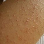 gluten1-e1470397380585