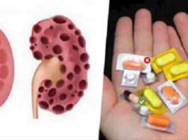 Tu Noteikti Kaut Reizi Esi Lietojis Šīs Zāles, Bet Nekad Dzīvē Vairs Tās Nelieto – Šīs Zāles Iznīcina Tavas Nieres, Bet Ārsti Joprojām Tās Izraksta!