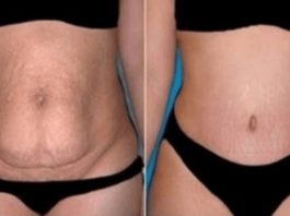 Sagatavo Šo Maisījumu Tikai 10 Minūšu Laikā – Izmanto To Vienu Reizi Dienā, Un Jau Pēc 20 Dienām Jūsu Vēdera Tauki Būs Zuduši Pavisam!