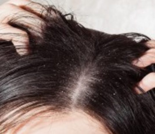 Pieci Vienkārši Un Pavisam Efektīvi Līdzekļi Cīņai Pret Blaugznām!