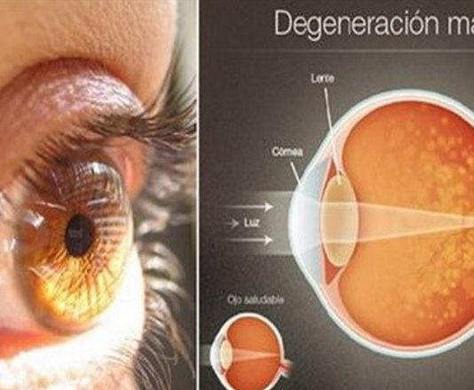 Aizmirsti Par Dārgām Un Sarežģītām Lāzeroperācijām! Šī Garšviela Palīdzēs Uzlabot Tavu Redzi Par 97%!