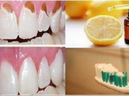 Novērs Savu Zobu Bojāšanos, Aizsargā Emāliju, Kā Arī Padari Zobus Daudz Baltākus Un Stiprākus Tikai Ar Vienu Īpašu Vielu!