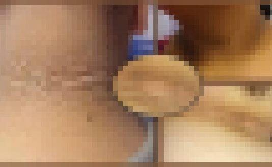 Šī Mamma Redzēja, Ko Dīvainu Apkārt Savas Meitas Kaklam. Ja Tu Pamani Šo Arī Savam Bērnam, Nekavējoties Dodies Uz Slimnīcu!