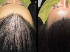 Ar Šo Eļļu Tavi Mati, Skropstas Un Uzacis Izaugs Nepārspējami Straujā Tempā!