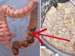 Apbrīnojama Mājas Mikstūra, Kas Attīrīs Jūsu Zarnas No Toksiskajiem Atkritumiem – Jutīsies Ne Tikai Labāk, Bet Arī Vairs Neslimosi!