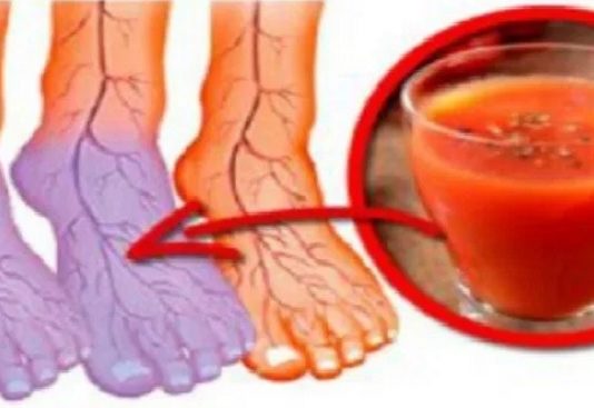 Slika Asins Cirukulācija Var Samazināt Cilvēka Mūža Ilgumu! Joprojām Aukstas Rokas Un Pēdas? Lūk, Kas Jums Ir Nepieciešams, Lai To Atrisinātu!