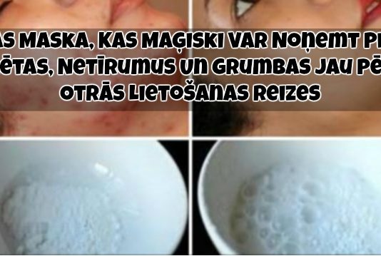 Fantastiski Vienkārša Sejas Maska, Kas Maģiski Var Noņemt Piņņu Rētas, Netīrumus Un Grumbas Jau Pēc Otrās Lietošanas Reizesv