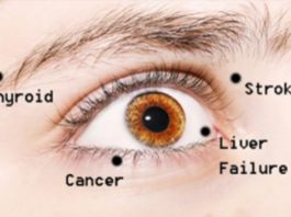 8 Bīstamas Lietas, Ko Jūsu Acis Cenšas Pastāstīt Par Jūsu Veselības Stāvokli – Lūk, Kā Uzzināt Vai Tev Ir Veselības Problēmas