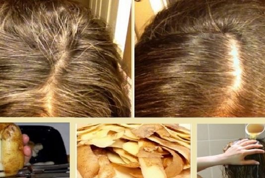 Šo Recepti Pamēģināja Mana 62 Gadus Vecā Māte Un Viņai Vairs Nav Neviena Sirma Mata! Tas Ir Lēti Un Pavisam Vienkārši!