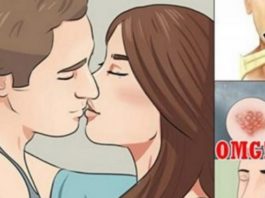 Uzzini Cik Patiesībā Bīstami Ir Skūpstīties! Veselas 8 Bīstamas Slimības, Ko Var Izraisīt Visparastākā Skūpstīšanās!