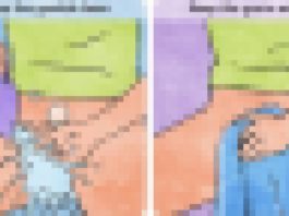 7 Ārstu Ieteikumi, Lai Saglabātu Savu Vagīnu Veselīgu Un Jaunu