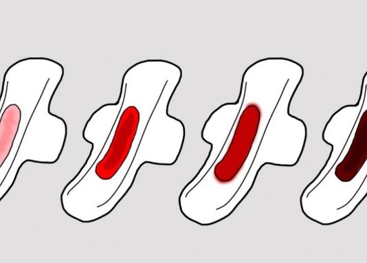 Lūk, Ko Īstenībā Nozīmē Un Pastāsta Par Jūsu Veselības Stāvokli Menstruāciju Asins Krāsa