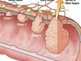 Kokosriekstu Eļļa Dara Brīnumus Jūsu Ādai Un Matiem. Bet Jūs Nokritīsiet No Krēsla Uzzinot Jauno Atklājumu, Ko Tā Patiesībā Var Izdarīt!