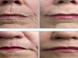 Apstrādājiet Savu Ādu Ar Šo Visiem Labi Zināmo Garšvieli Un Jūsu Krunciņas Būs Pazudušas