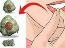 Vēzi Ir Iespējams Apturēt – Katru Dienu Ēdos Šos Piecus Ēdienus. Pēdējais Laiks Sākt Tos Ēst!