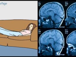 Kurš Gan To Būtu Domājis – Slinkas Smadzenes Tevi Lēnām Paralizē – Patīk Slinkot? Tas Var Beigties Ar Nopietniem Smadzeņu Bojājumiem!