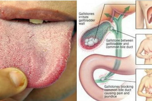 Jums Steidzami Jāatrīra Ķermeni No Toksīniem, Ja Pamanat Kādu No Šīm Brīdinājuma Zīmēm!