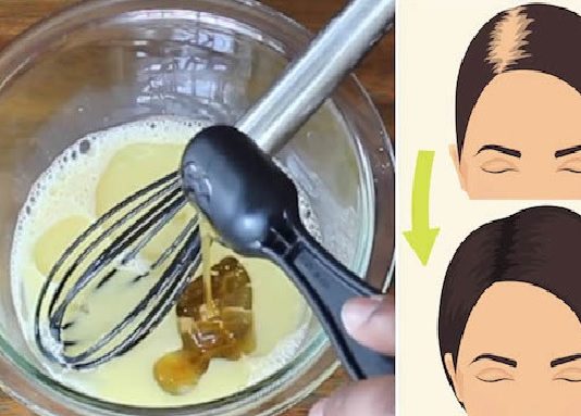 Bojāti Mati, Kas Vēl Krīt Ārā? Izmanto Šo Trīs Sastāvdaļu Recepti Un Padari Savus Matus, Kā Junus!