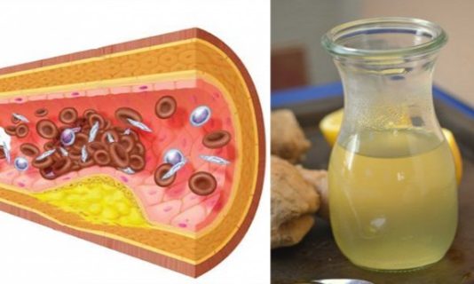 Aizmirsti Par Dārgajām Asinsspiediena Un Holesterīna Zālēm. Šis Palīdzs Labāk!