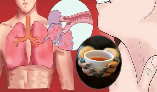 Katrs Malks Šīs Tējas Attīrīs Plaušas No Gļotām, Toksīniem Un Iekaisumiem. Tā Sastāv Vien No 3 Sastāvdaļām