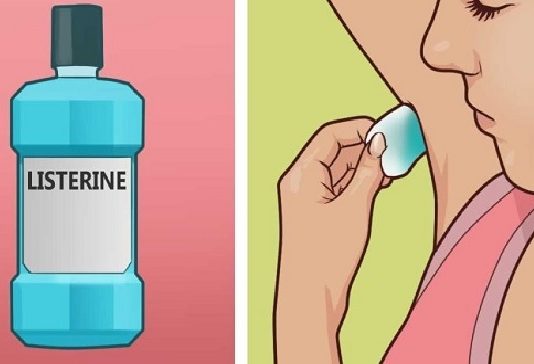 Viņa Paņēma Un Izlēja Listerīnu Uz Vates Bumbiņas Un Tad Paberzēja To Pret Savu Padusi – Lūk Kas Notika Pēc Pāris Minūtēm