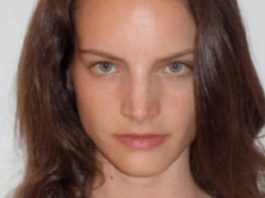 Šī Meitene Izdzīvo Ar 3 Āboliem Dienā Un Tā 8 Gadus. Aplūko, Kāda Viņa Izskatās Tagad – Šausmas!