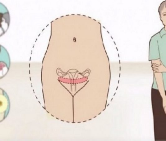 28 Simptomi, Kas Liecina, Ka Tev Tuvojas Menopauze