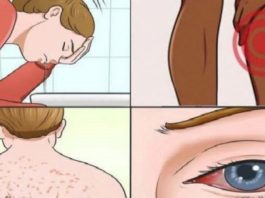 Pazīmes, Ka Tev Mājās Ir Iemetinājusies Sēnīte Un Par To Nemaz Nezini. Lūk, Kas Ar Tevi Notiek