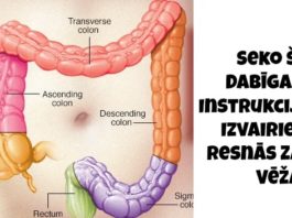 Seko Šīm Dabīgajām Instrukcijām Un Izvairies No Resnās Zarnas Vēža