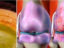 Tas Nekavējoties Rekonstruē Kaulus Un Locītavas, Kā Arī Dziedina Ceļgalus – Aizmirsti Par Ārstiem Ja Tev Šī Recepte!