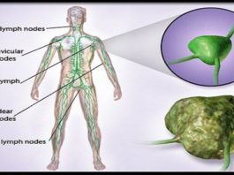 Vēzis Nomirst Ēdot Šos 7Parastos Ēdienus. Pienācis Laiks Sākt Tos Ēst!