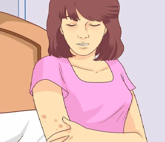 Ļoti Bīstamas Pazīmes, Kas Liecina To, Ka Tavā Ķermenī Attīstās Vēzis