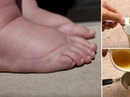 Ūdens Aizture Tavā Organismā Var Būt Dzīvībai Bīstama – Uzzini Kā No Tās Nekavējoties Atbrīvoties!