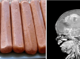 Ārstu Asociācija Brīdina Ikvienu! Nekavējoties Beidziet Ēst Hotdogus. Tas Var Beigties Ļoti Bēdīgi