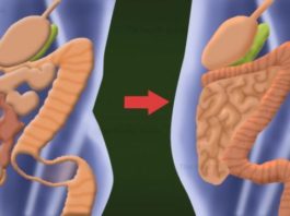 Jau Šodien Atbrīvojies No Aptuveni 10 Kilogramiem Toksīnu, Kas Uzkrājušies Taavās Zarnās, Izmantojot Vien Šos Divus Produktus