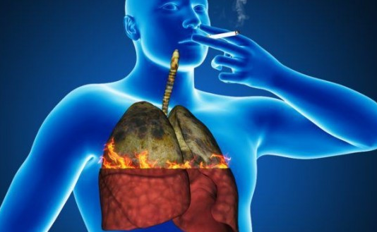 Šis Noderēs Visiem Smēķētajiem! 6 Pavisam Vienkārši Veidi, Kā Pavisam Dabiski Attīrīt Plaušas No Netīrās Darvas, Kas Neļauj Tev Elpot