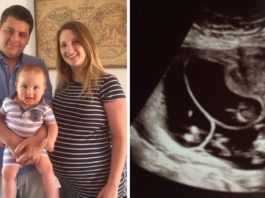 Par Spīti Ārsta Teiktajam, Viņa Divas Reizes, Dabīgā Veidā Palika Stāvoklī, Dodot Cerību Visām Sievietēm, Kuras Ir Neauglīgas