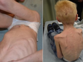 Pilnīgs Vājprāts! Vecāki Ieslēdza Savu Mazo Dēlu Skapī Uz Vairākiem Mēnešiem – Tajā Metot Vien Ēdiena Paliekas, Viņš Nenomira, Bet Tālākais Šokēja Visus