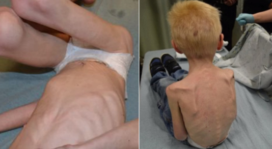 Pilnīgs Vājprāts! Vecāki Ieslēdza Savu Mazo Dēlu Skapī Uz Vairākiem Mēnešiem – Tajā Metot Vien Ēdiena Paliekas, Viņš Nenomira, Bet Tālākais Šokēja Visus