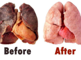 Eliksīrs, Kas Pilnībā Attīrīs Tavas Plaušas. Īpaši Ieteicams Smēķētājiem