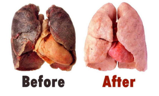 Eliksīrs, Kas Pilnībā Attīrīs Tavas Plaušas. Īpaši Ieteicams Smēķētājiem