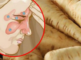 Atbrīvojies No Iekaisušiem Elpceļiem Un Galvassāpēm Vien Piecās Dienās