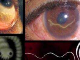 Piesargieties! Ja Jūs ēdat šo pārtiku, Jūsu ķermenis tiks piepildīts ar tārpiem no iekšpuses!