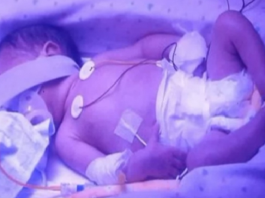 Ārsti sašutuši par to, ko pēc grūtnieces nāves atklāja viņas ķermenī! Pretīgi