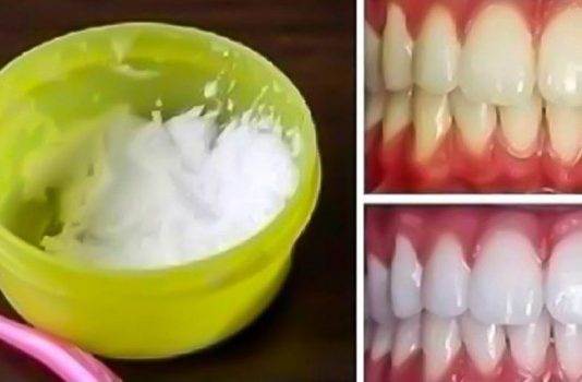 10 Minūtes un zobi būs baltāki par baltiem! Zobārsti to slēpj!