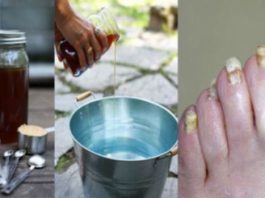 Vēlies atbrīvoties no kāju sēnītes uz visu atlikušo mūžu? Sajauc divas sastāvdaļas un izbaudi dzīvi bez raizēm!